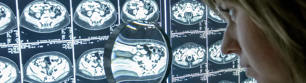 Ausbildung zur Medizinisch-technischen Radiologieassistenz (m/w/d)