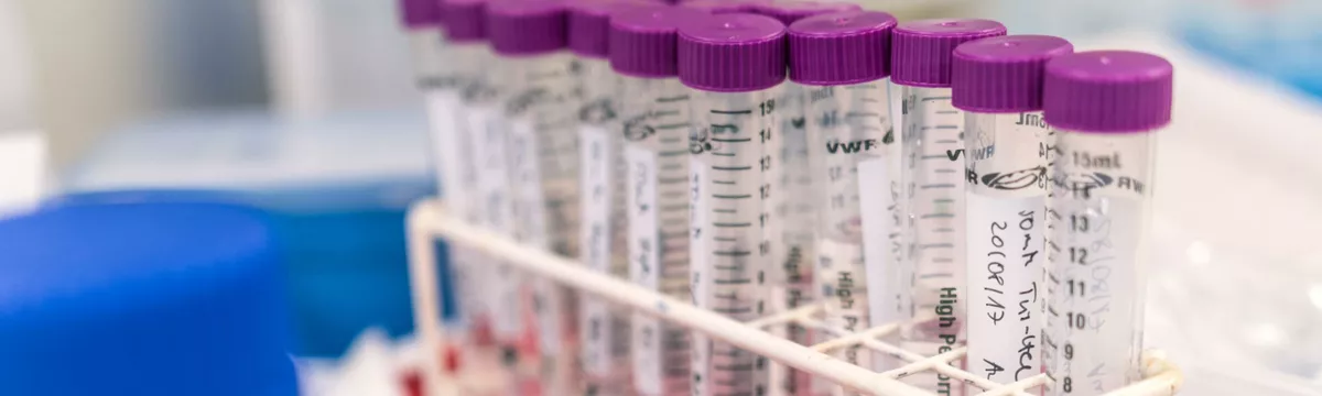 Sustainable and Innovative Natural Resource Management (SINReM) (M.Sc.)