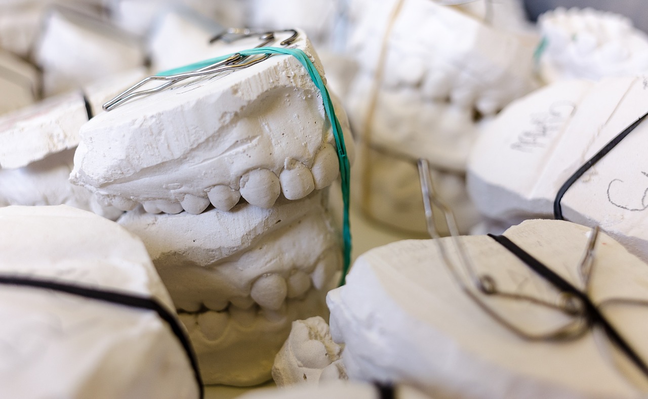Die Abdrücke vom Zahnarzt dienen als Negativ für die Anfertigung von Gipsmodellen